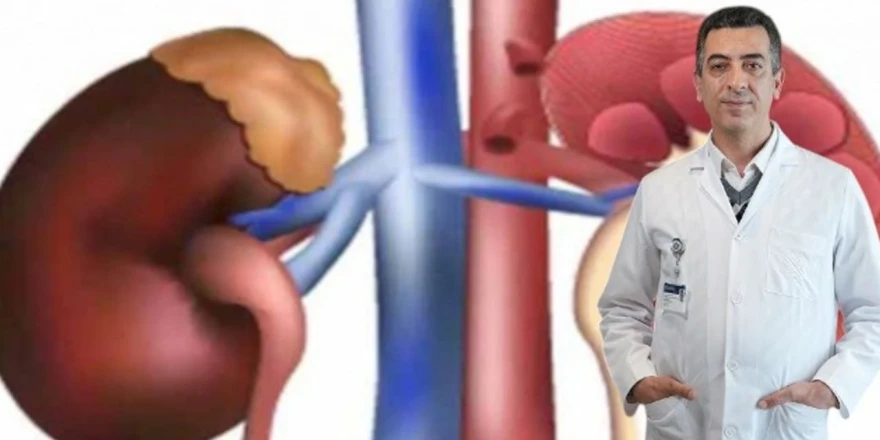 Yaz Aylarında Böbrek Hastaları İçin En Büyük Tehdit: Hatalı Beslenme Ve Fazla Sıvı Tüketimi!